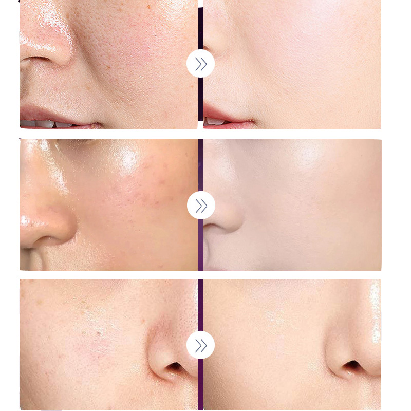 Роскошный благородный фотограф – обзор и цена Luxury Skincare China